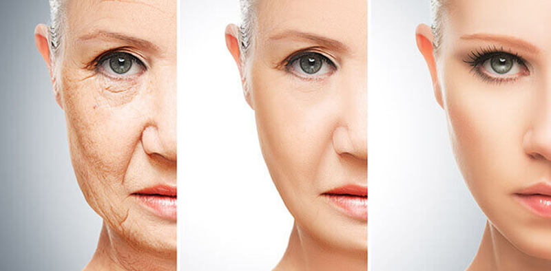 Anti-Aging-Facial-عکس-بزرگ.png